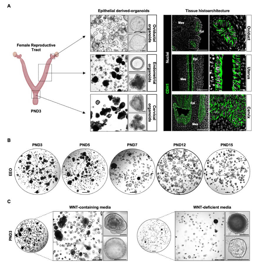 Establecimiento y caracterización de organoides uterinos neonatales. Imágenes representativas de organoides derivados del tracto reproductor femenino de ratones postnatales (día 3), incluyendo oviducto, útero y cérvix. Se observa la morfología epitelial mediante campo claro e inmunofluorescencia para CDH1, así como la evolución de organoides endometriales en distintos días postnatales y bajo condiciones con o sin señalización WNT.