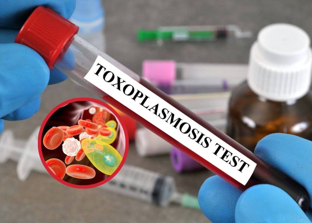 Toxoplasmosis congénita, el parásito silencioso que puede cruzar la placenta