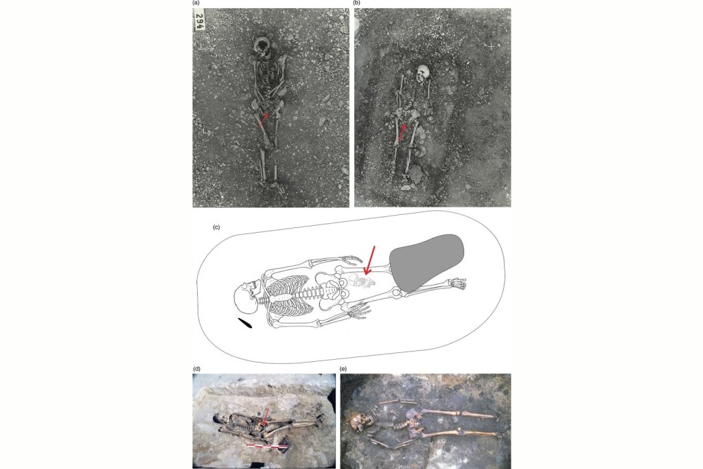 Imágenes y esquemas de posibles enterramientos conjuntos de madre e hijo. (a–b) Tumbas 294 y 228 en Kopparsvik, según el estudio de Toplak (2016)