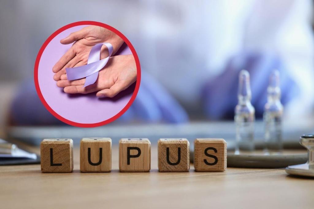 lupus