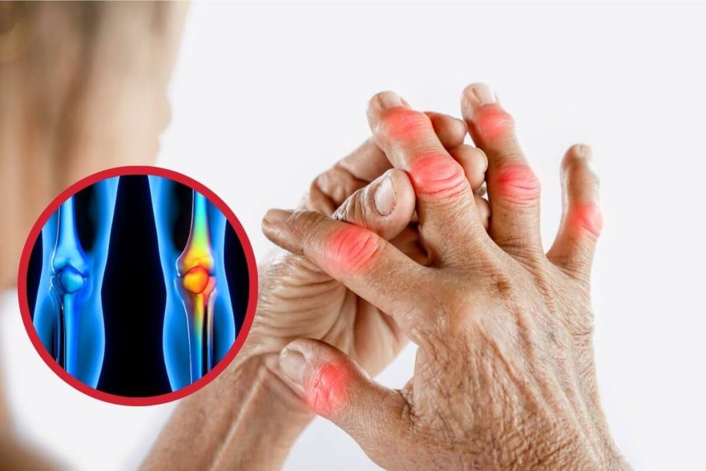 las principales enfermedades autoinmunes explicadas una a una 3