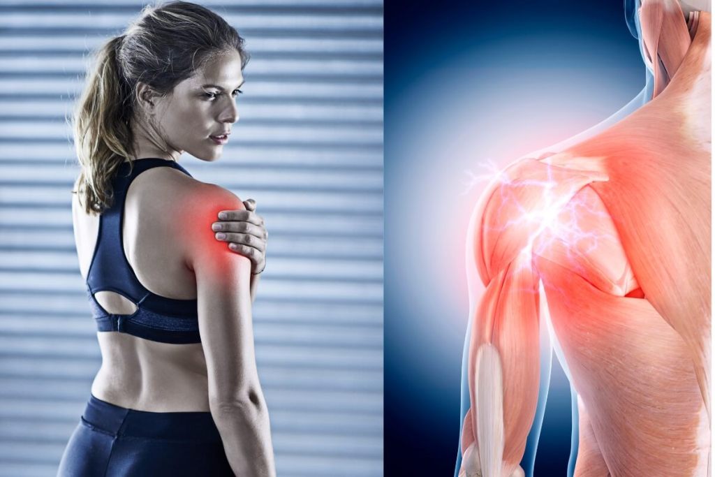 Mujer con dolor en el hombro