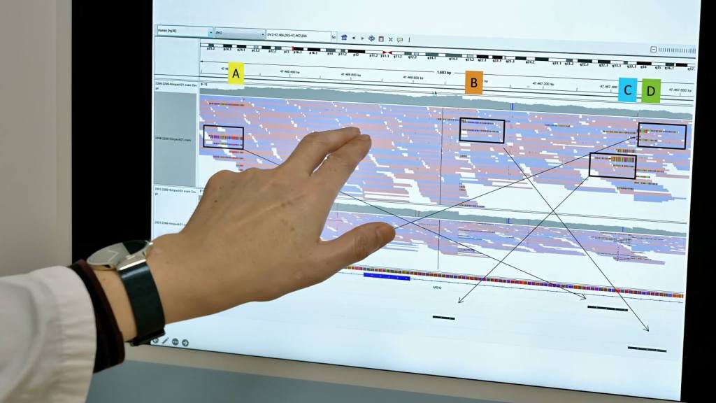 Identifican una nueva causa genética de los trastornos del neurodesarrollo que ofrece respuestas a miles de familias