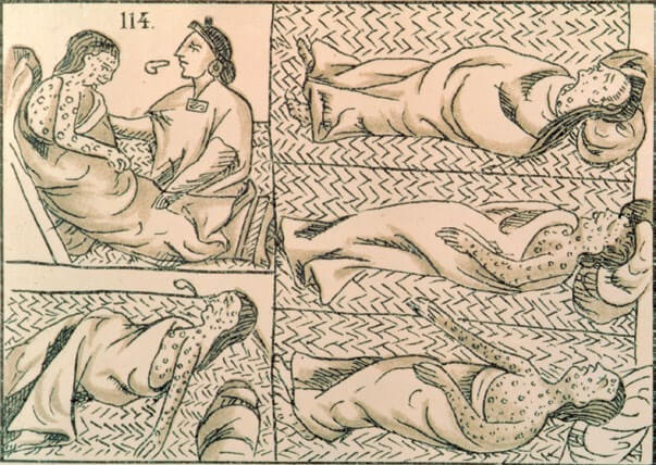 Indígenas afectados por viruela