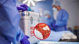 Trasplantes de órganos, el desafío de engañar al sistema inmunitario para que no los rechace