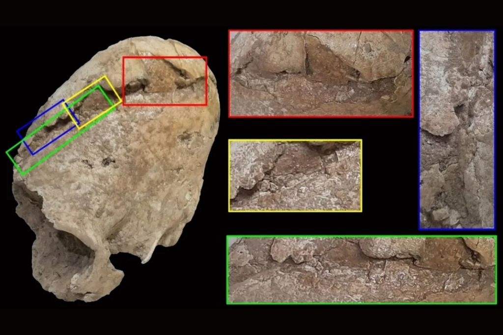 El cráneo de esta joven de la Edad del Cobre muestra signos claros de una lesión traumática ocurrida en los momentos finales de su vida