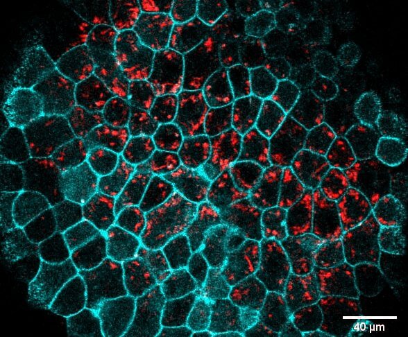 Haciendo contacto, nuestro primer encuentro con los habitantes del micromundo 2