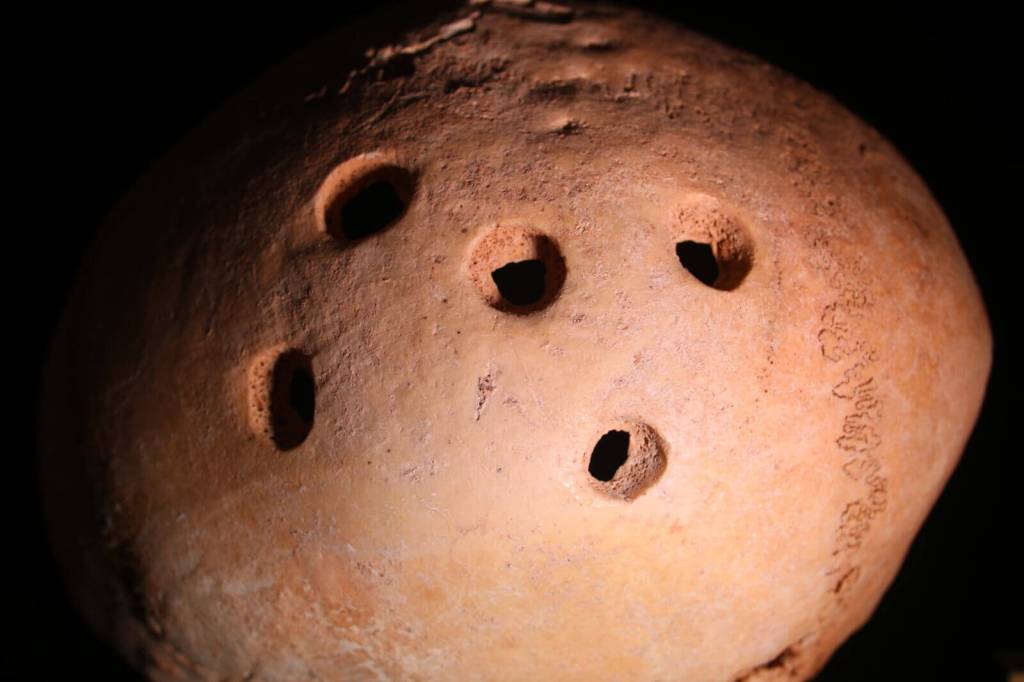 Imágenes del cráneo menorquín del Barranc d’Algendar: Cinco trepanaciones realizadas en momentos distintos. Unas antes de morir el individuo, y otras después (Créditos: C. Sobrado y E. Camarós, USC).