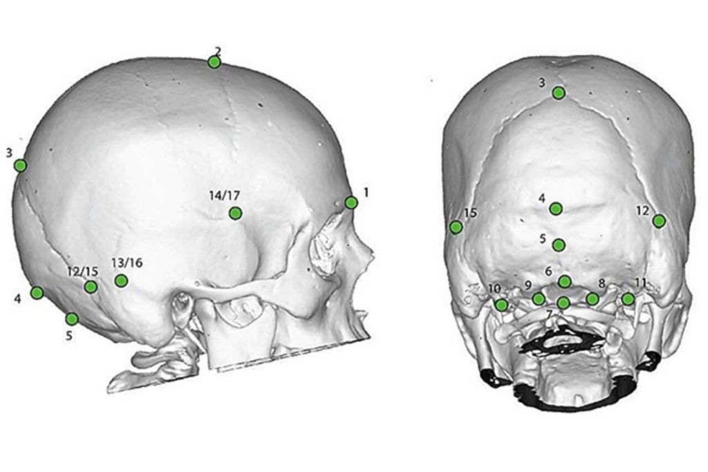 Los investigadores analizaron y compararon las formas craneales de humanos actuales y fósiles de antiguas especies humanas