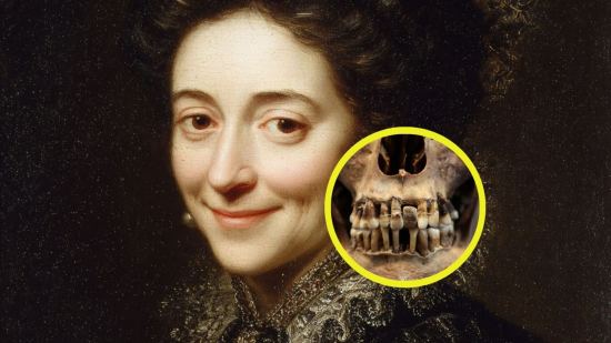 Tratamientos dentales de la Europa moderna