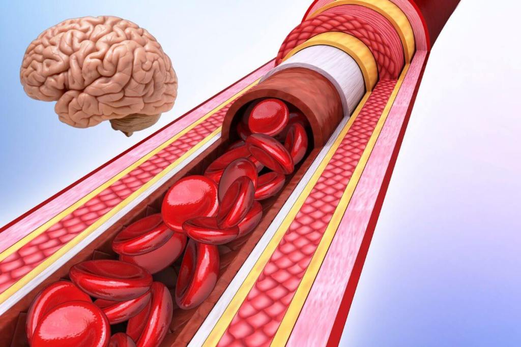 Esto es lo que una comida alta en grasas le hace a un cerebro sano en solo 4 horas 2