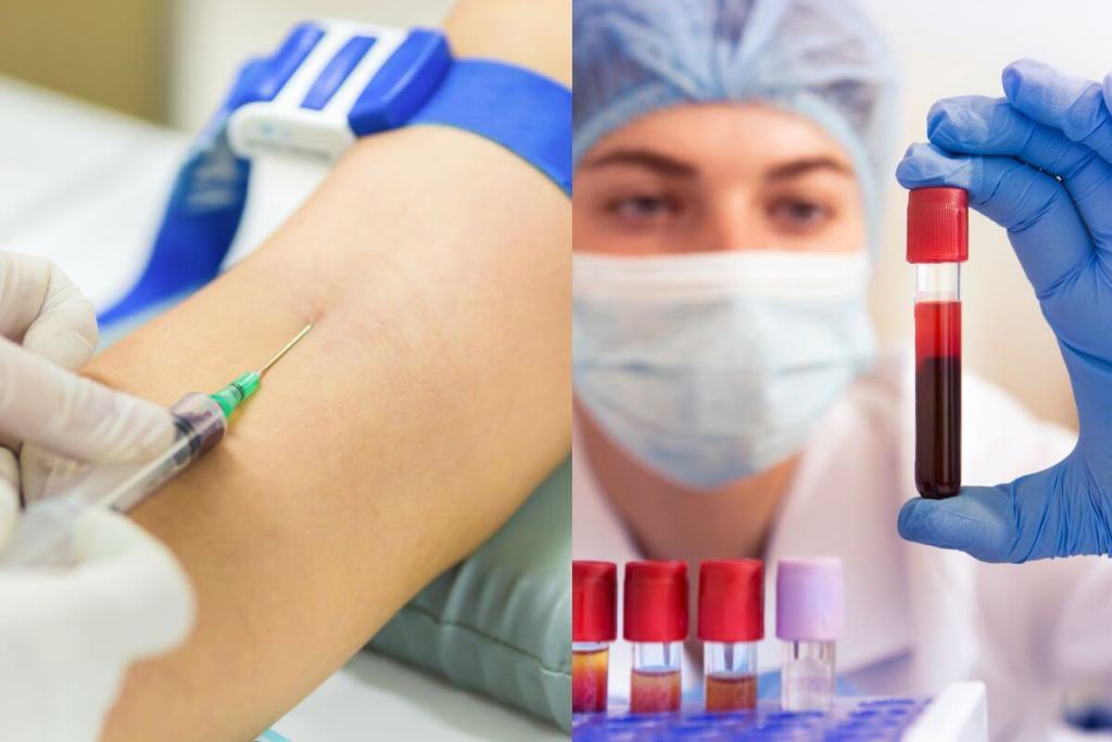 No todo está en la cabeza, un análisis de sangre abre la puerta a diagnosticar la fatiga crónica 2