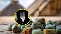 Incrustaciones dentales