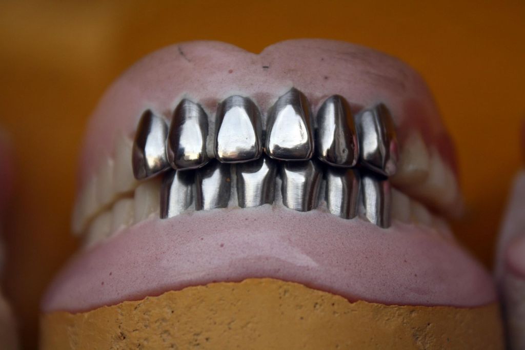 Dientes de metal