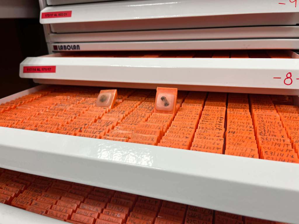 Los biobancos son clave para estudiar enfermedades raras, diseñar terapias personalizadas y avanzar en medicina preventiva.