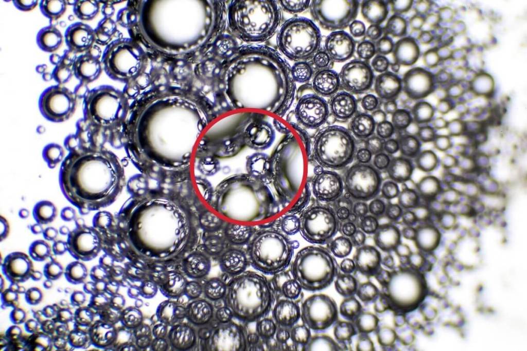 Científicos descubren cómo un virus escondido en la saliva activa una enfermedad autoinmune 