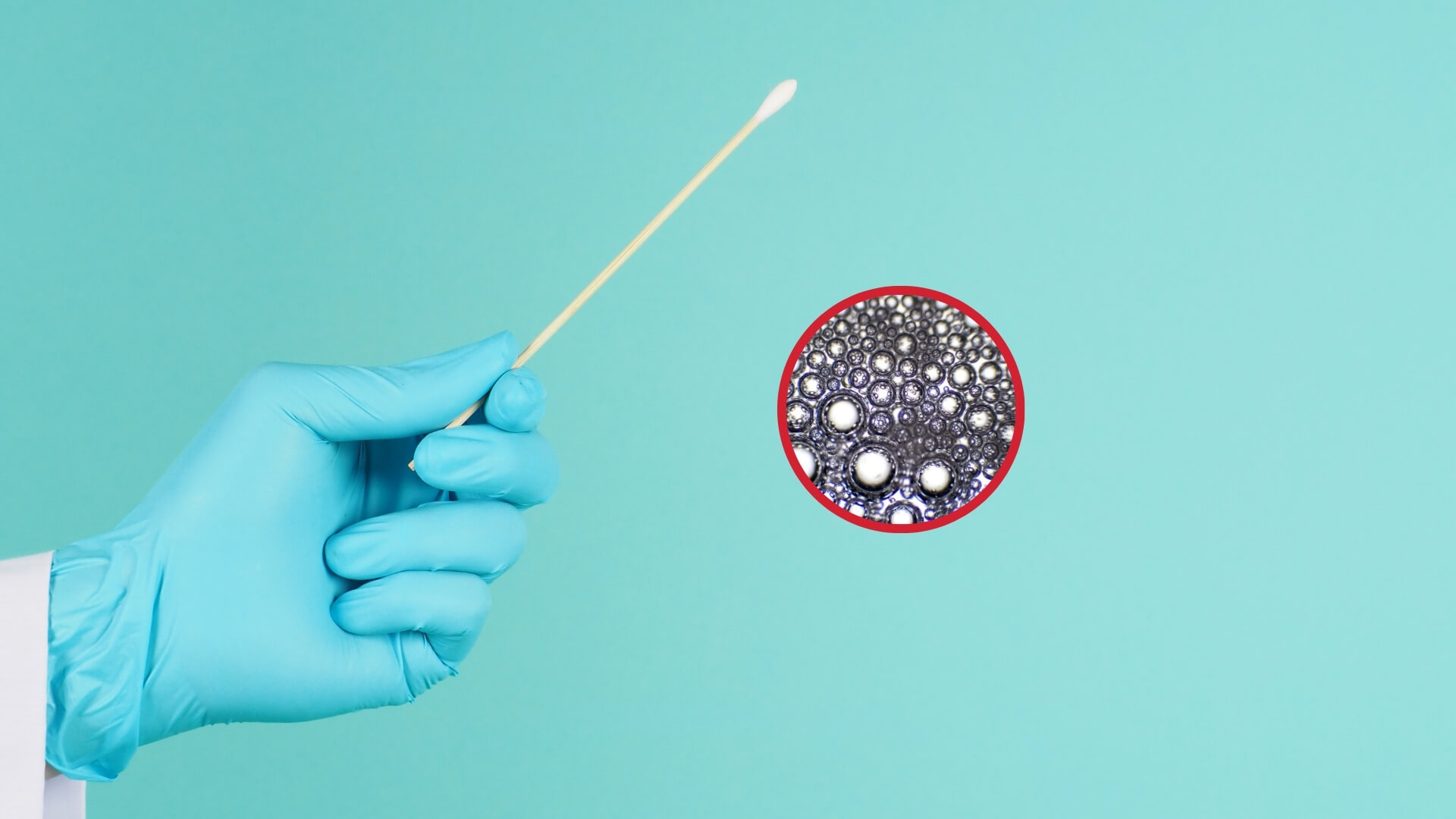 Científicos descubren cómo un virus escondido en la saliva activa una enfermedad autoinmune