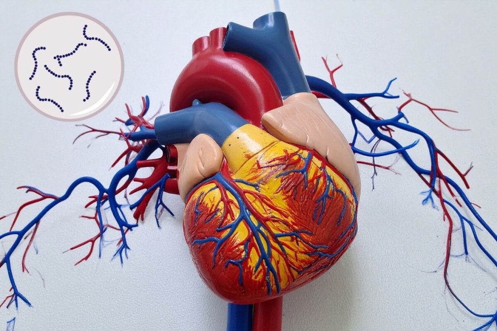 Un hallazgo sorprende a los científicos- bacterias orales se esconden en las arterias y podrían impulsar la ruptura que causa infartos. 2