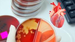 Un hallazgo sorprende a los científicos- bacterias orales se esconden en las arterias y podrían impulsar la ruptura que causa infartos