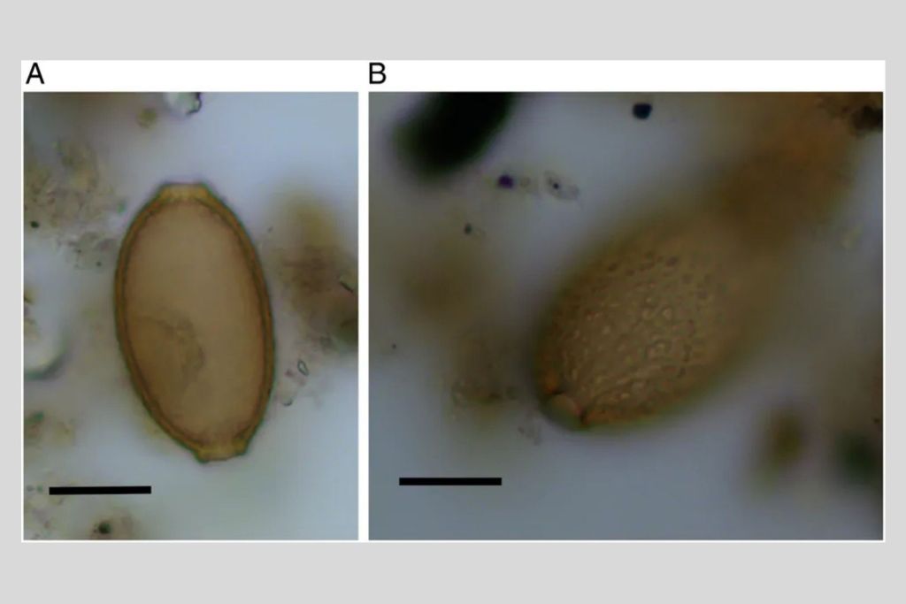Imagen microscópica de los huevos de parásitos hallados en las heces de humanos y perros del Neolítico cerca de Stonehenge