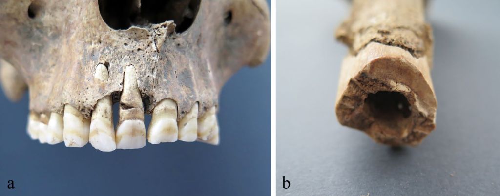 Esqueletos de soldados romanos