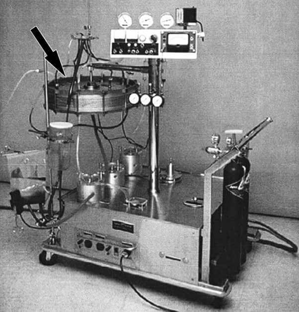 Cuando el corazón se detiene, la tecnología sigue latiendo- cómo la terapia ECMO mantiene viva la esperanza 3