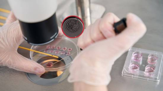 Crean por primera vez embriones humanos usando núcleos de células de la piel y esperma, pero aún no es un tratamiento