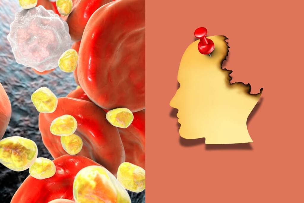 La grasa roba la memoria… y las moscas lo probaron en el laboratorio 2