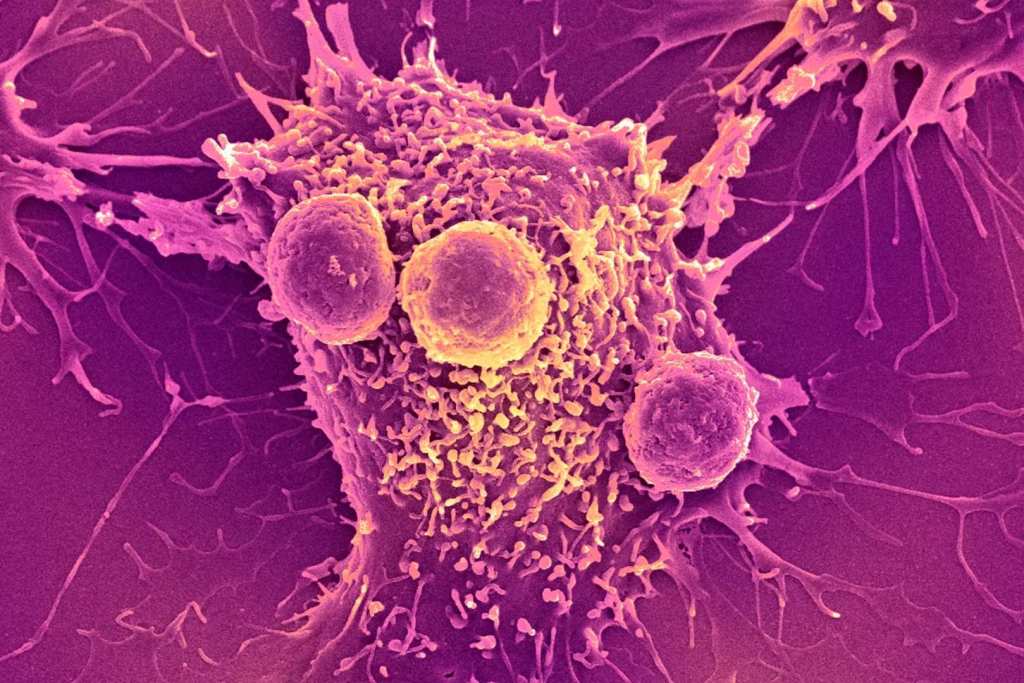 Con el impulso adecuado, tus células inmunes pueden convertirse en asesinas implacables de tumores