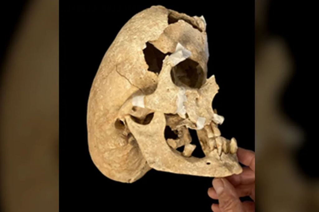 El cráneo del caballero medieval presentaba una forma extremadamente alargada y estrecha, fuera de lo común para su época