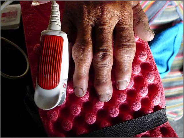 Medición no invasiva de la concentración de hemoglobina y de la saturación de oxígeno en participantes del estudio. Fotografía de Sienna R. Craig.